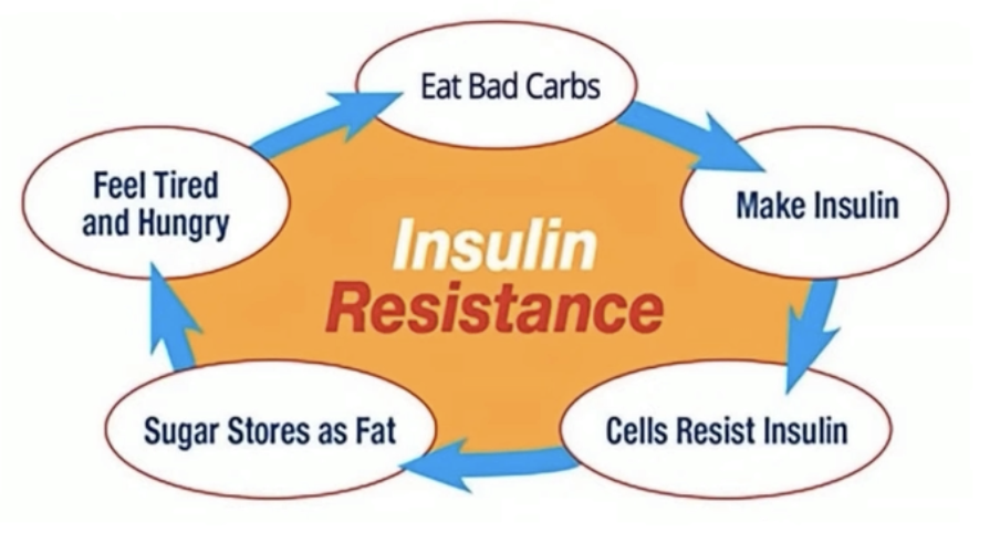 insulin resistance